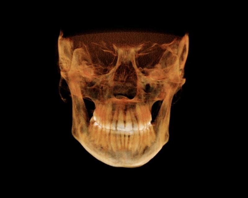 Oral Radiologists OralRadiologists