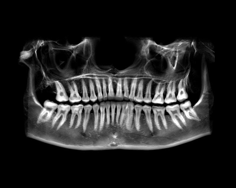Oral Radiologists OralRadiologists