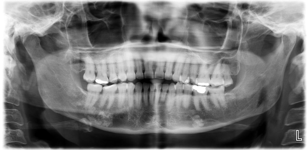 Expert CBCT Interpretation Services Oral Radiologists, LLC